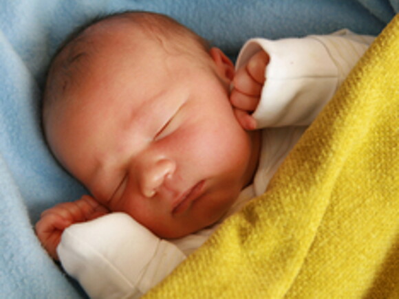 Jaundice In Newborns