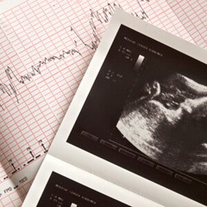 Can Fetal Heartbeat Predict A Baby’s Gender?