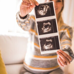 Questions to ask at your 12-week scan