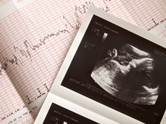 Can Fetal Heartbeat Predict A Baby’s Gender? Can Fetal Heartbeat Predict A Baby’s Gender?