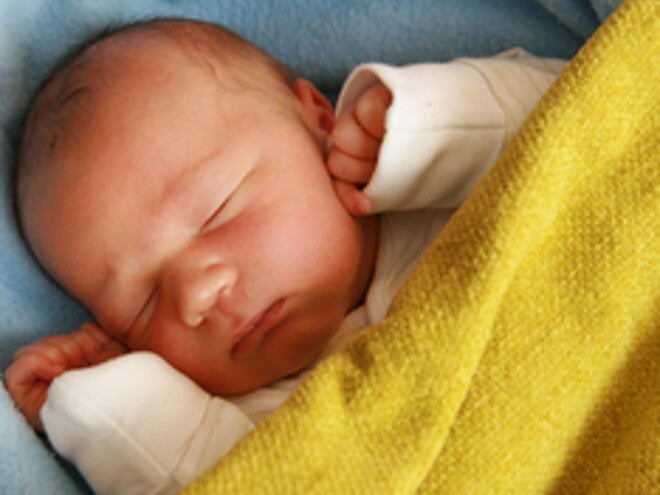 Jaundice In Newborns