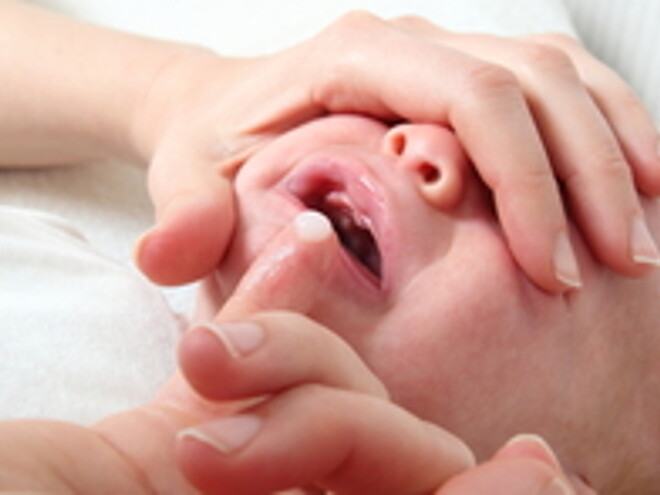 Oral Thrush: Signs and Remedies Oral Thrush: Signs and Remedies